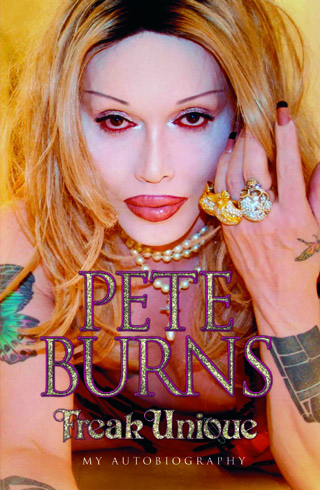 Pete Burns